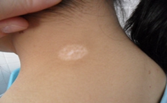 ��Щԭ��ᵼ�°�����ɢ��