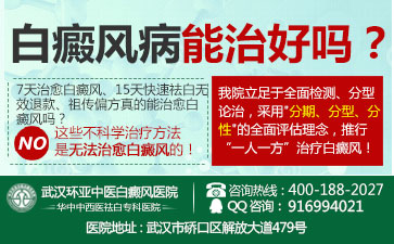 预防白癜风的常识有什么 预防白癜风的常识有什么