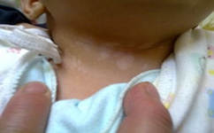 ��ǻ�Ĥ�������Ʒ�����ʲô