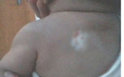 ����Ĳ���֢״����Щ