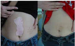 Ů�������ЧԤ�������