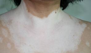 ���ڰ��緢���Ĳ���