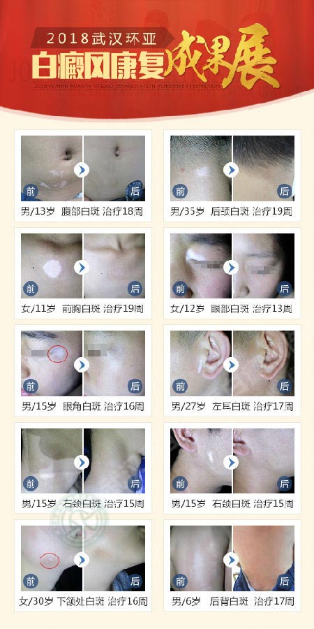 �人���ǰ���ҽԺ