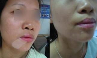 �人�ΰ��������Ƥ�����ְ׿�