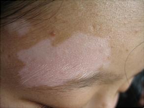 �人���ǰ���ҽԺ��ַ��Ȱ���ͼƬ