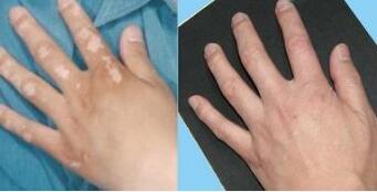 �人��õİ���ҽԺ�׷��ͼƬ