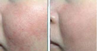 �人����ҽԺ��Ȱ���ͼƬ