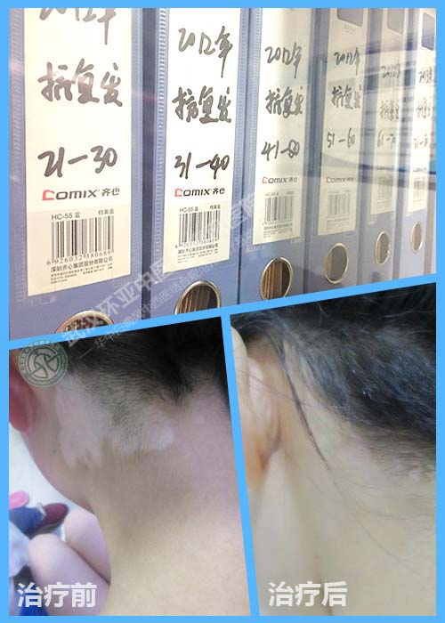 ӭ���껻���ա����ٰ���סԺǿ������