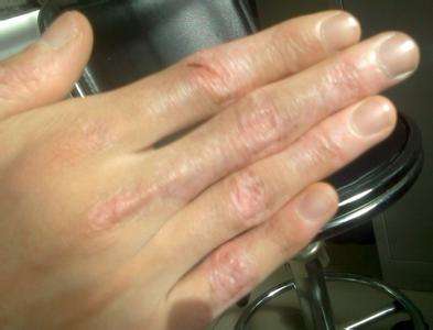 �人�л���ҽԺ�����аװ�