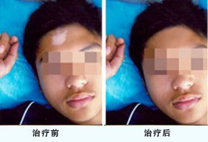 ��ͯ�����а�����Ҫע����Щ��������