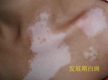 �人����������������ѣ��װߴ����׸�����������Ժǿ������ɢ