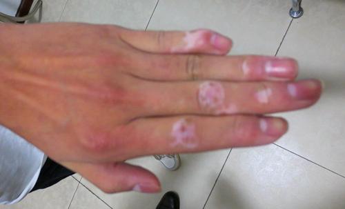 �人���ǰ���ҽԺ��ʾ���װ߻��߲����ٵ�������ҩ���塱��