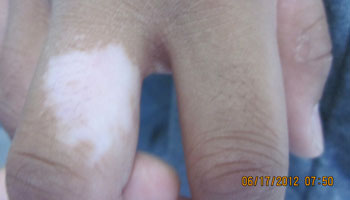 �人Ƥ���ϰװ��ǲ��ǰ���