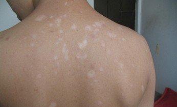 �人�沿��������Ӧ��ע��ʲô