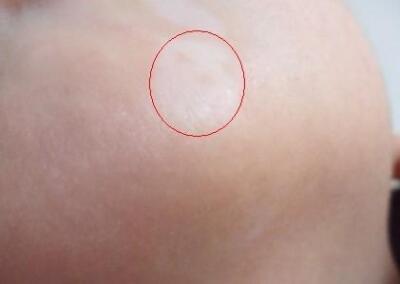 �人����ר��ҽԺ�����ģ�����������ʱ�ڿɱ��ΰװ߷�չ