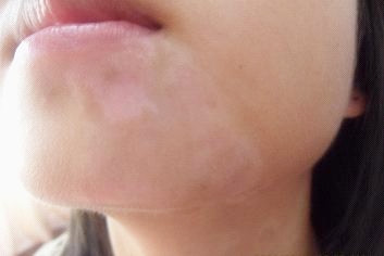 �人�����а���Ӧ����ô������