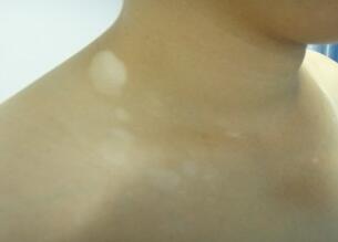 �人Ԥ�����緽������Щ