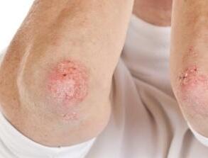 �人�ļ�����߷���ʲôԭ��