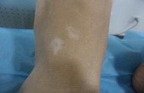 �人Ƥ���������Ʒ�����Щ