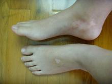 �人�����֢״����������Щ