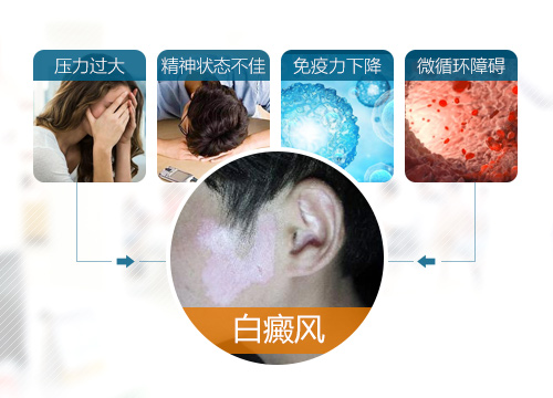 ��������հ�Ů�ɰ��粡����������ҽ���ÿ���