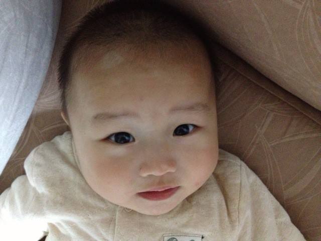 武汉治儿童白癜风的医院是哪家