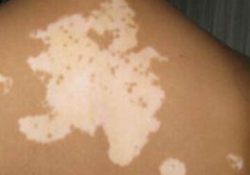 �人����Ԥ����֪��