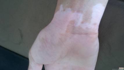 �人����Ԥ��ע��Щʲô