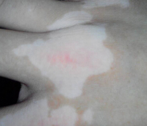 �人���������Ԥ����