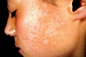 �人���粻ͬʱ��֢״��ʲô