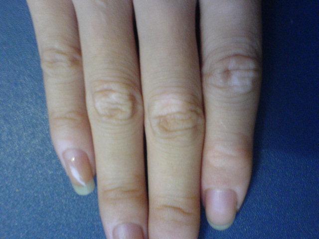 �人Ϊ�ΰ���İװ��׳������ֲ�