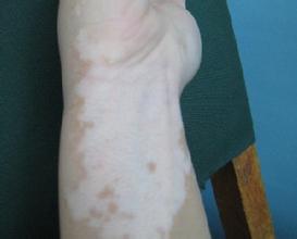 �人�����ڰ�����ϵļ�鷽��