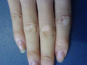 �人����Ҫע��ʲô������