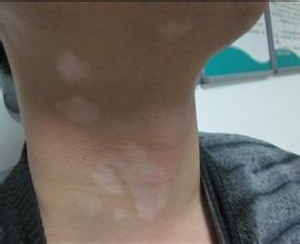 �人��ͯ��������Ʒ��ø�ô