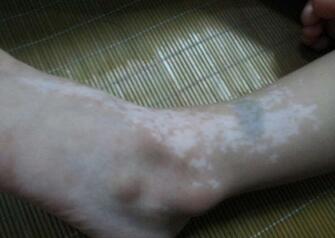 �人�����������ȥ���Ʋź�