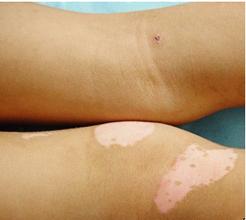 �人�����������ע������