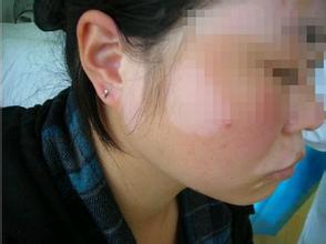 �人ҽԺ�׻��Ǻ�����