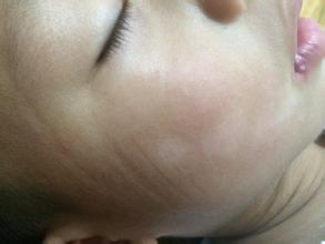 武汉医院白环亚美赞