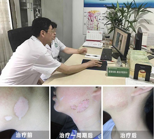 �ļ����缫�ٸ�ɫ�ƻ�