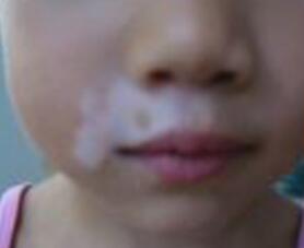 武汉医院看白板环亚