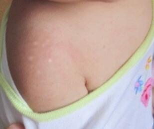 武汉看白殿环亚礼