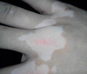 �人�׵�ỷ��