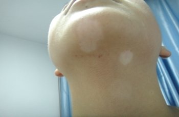 武汉白颠疯环亚特约