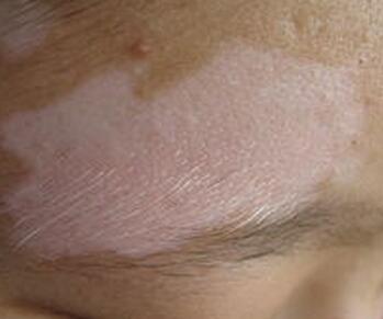 武汉治白殿环亚礼