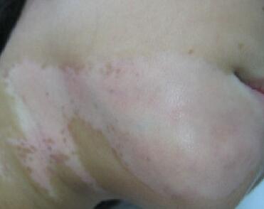 武汉看白殿丰环亚